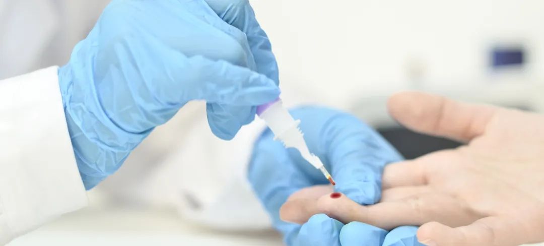 腺苷脱氨酶(ADA)临床意义解读